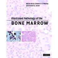 Illustrated Pathology of the Bone Marrow by Attilio Orazi , Dennis P. O'Malley , Daniel A. Arber, 9780521810036