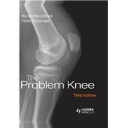 The Problem Knee, Third Edition by Macnicol; Malcolm, 9781444120110