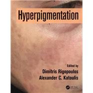 Hyperpigmentation by Rigopoulos; Dimitris, 9781498740173