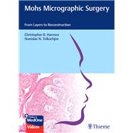 Mohs Micrographic Surgery: From Layers to Reconstruction by Christopher B. Harmon; Stanislav N. Tolkachjov, 9783132420175