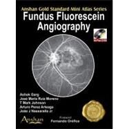 Fundus Fluorescein Angiography (Book with Mini CD-ROM) by Garg, Ashok, 9781905740260