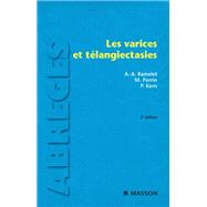Les varices et tlangiectasies by Albert-Adrien Ramelet; Michel Perrin; Philippe Kern, 9782994100348