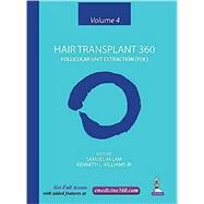Hair Transplant 360 by Lam, Samuel M.; Williams, Kenneth L., Jr., 9789352500369