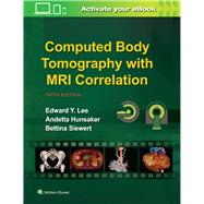 Computed Body Tomography With MRI Correlation by Lee, Edward Y.; Hunsaker, Andetta; Siewert, Bettina, 9781496370495