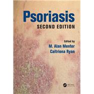 Psoriasis by Author, 9781498700535