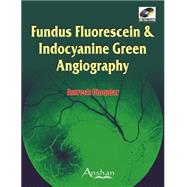 Fundus Fluorescien & Indocyanine Green Angiography (Book with CD-ROM) by Chopdar, Amresh, 9781905740574
