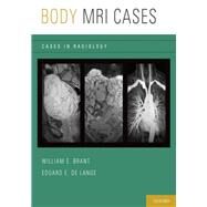 Body MRI Cases by Brant, William E.; de Lange, Eduard E., 9780199740710