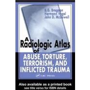 A Radiologic Atlas of Abuse, Torture, Terrorism, and Inflicted Trauma by Brogdon, B. G.; Vogel, Hermann; McDowell, John D., 9780203010853