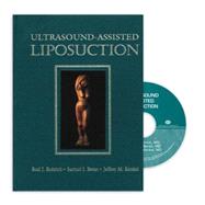 Ultrasound-assisted Liposuction by Rohrich, Rod J.; Beran, Samuel J.; Kenkel, Jeffrey M., 9781576261095