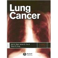 Lung Cancer by Roth, Jack A.; Cox, James D.; Hong, Waun Ki, 9781405151122
