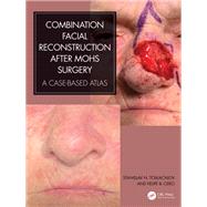 Combination Facial Reconstruction after Mohs Surgery by Stanislav N. Tolkachjov; Felipe B. Cerci, 9781000901191
