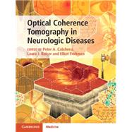 Optical Coherence Tomography in Neurologic Diseases by Calabresi, Peter A., M.D.; Balcer, Laura J., M.D.; Frohman, Elliot M., M.D., Ph.D., 9781107041301