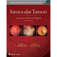 Intraocular Tumors: An Atlas and Textbook by Shields, Jerry A.; Shields, Carol L., 9781496321343
