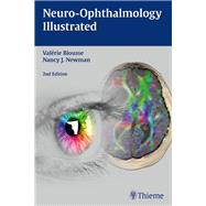 Neuro-ophthalmology Illustrated by Biousse, Valerie, M.D.; Newman, Nancy J., M.D., 9781626231498