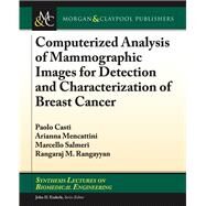 Computerized Analysis of Mammographic Images for Detection and Characterization of Breast Cancer by Casti, Paola; Mencattini, Arianna; Salmeri, Marcello; Rangayyan, Rangaraj M.; Enderle, John D., 9781681731568