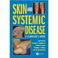 Skin and Systemic Disease: A Clinicians Guide by English III; Joseph C., 9781482221589