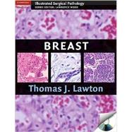 Breast by Thomas J. Lawton, 9780521881593