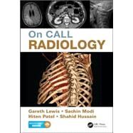 On Call Radiology by Lewis; Gareth, 9781482221671