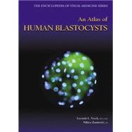 An Atlas of Human Blastocysts by Veeck; Lucinda L., 9781842141694