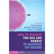 How to Prepare the Egg and Embryo to Maximize IVF Success by Kovacs, Gabor; Rutherford, Anthony; Gardner, David K., 9781316621776