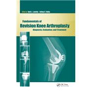 Fundamentals of Revision Knee Arthroplasty by David Jacofsky; Anthony Hedley, 9781040141830
