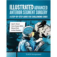 Illustrated Advanced Anterior Segment Surgery by Ahmed, I.; Mller, X.; Shah, M.; Sheybani, A., 9781630911843