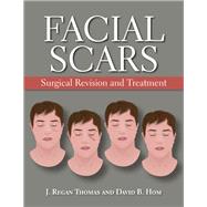 Facial Scar Revision by Thomas, J. Regan; Hom, David, 9781607951865