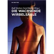 Die Wachsende Wirbelsule by Stcker, Ralf; Hasler, Carol; Deimling, Urs von (CON); Hefti, Fritz (CON); Herrmann, Friedrich (CON), 9783110461879
