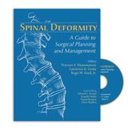 Spinal Deformity: A Guide to Surgical Planning and Management (Book with DVD) by Mummaneni, Praveen V., M.D., 9781576261897