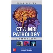 CT & MRI Pathology: A Pocket Atlas, Third Edition by Grey, Michael; Ailinani, Jagan, 9781260121940