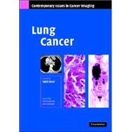Lung Cancer by Edited by Sujal R. Desai, 9780521872027