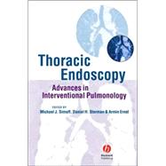 Thoracic Endoscopy Advances in Interventional Pulmonology by Simoff, Michael J.; Sterman, Daniel H.; Ernst, Armin, 9781405122047