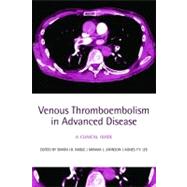 Venous Thromboembolism in Advanced Disease A clinical guide by Noble, Simon I R; Johnson, Miriam J; Lee, Agnes Y Y, 9780199232048
