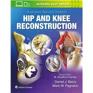 Illustrated Tips and Tricks in Hip and Knee Reconstructive and Replacement Surgery by Berry, Daniel J.; Pagnano, Mark W., 9781496392060