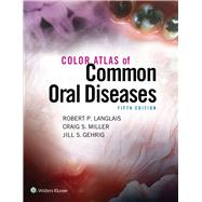 Color Atlas of Common Oral Diseases by Langlais, Robert P., 9781496332080