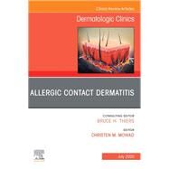 Allergic Contact Dermatitis, an Issue of Dermatologic Clinics by Mowad, Christen M., 9780323712132