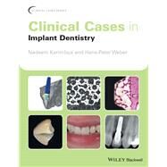 Clinical Cases in Implant Dentistry by Karimbux, Nadeem; Weber, Hans-peter, 9781118702147