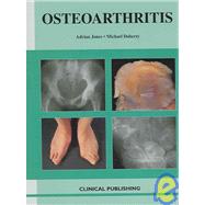 Oesteoarthritis: An Atlas of...,Jones; Adrian,9781904392163