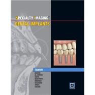 Dental Implants by Tamimi, Dania Faisal; Koenig, Lisa J.; Al-Ekrish, Asma'a Abdurrahman; Rathi, Shikha; Schetritt, Avi, 9781937242190