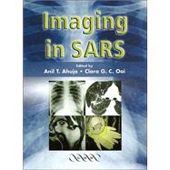 Imaging in SARS by Edited by A. T. Ahuja , C. G. C. Ooi, 9781841102191