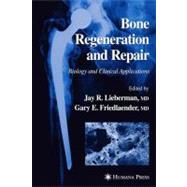 Bone Regeneration and Repair by Lieberman, Jay R., M.D.; Friedlaender, Gary E., M.D., 9781617372193