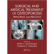 Surgical and Medical Treatment of Osteoporosis: Principles and Practice by Giannoudis; Peter V., 9781498732246