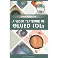 A Video Textbook of Glued Iols by Agarwal, Amar, 9781630912246