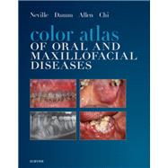 Color Atlas of Oral and Maxillofacial Diseases by Neville, Brad W.; Damm, Douglas D.; Allen, Carl M.; Chi, Angela C., 9780323552257