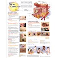 Understanding Skin Cancer Anatomical Chart by Unknown, 9781975192303