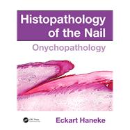 Histopathology of the Nail: Onychopathology by Haneke; Eckart, 9781482212327