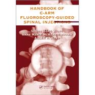 The Handbook of C-Arm Fluoroscopy-Guided Spinal Injections by Wang, M.D., Ph.D.; Linda Hong, 9780849322549