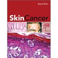 Skin Cancer by Nouri, Keyvan, 9780071472562