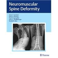 Neuromuscular Spine Deformity by Samdani, Amer F., M.D.; Newton, Peter O., M.d.; Sponseller, Paul D., M.D.; Shufflebarger, Harry L., M.D., 9781626232600