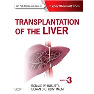 Transplantation of the Liver by Busuttil, Ronald W., M.D., Ph.D.; Klintmalm, Goran B. G., M.D., Ph.D., 9781455702688